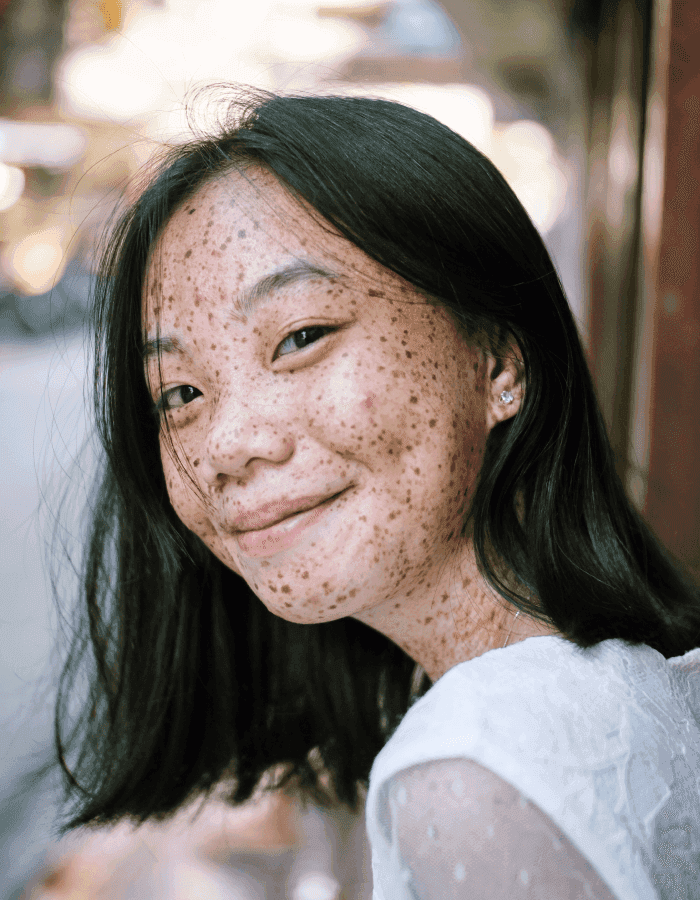 Woman with freckles smiling